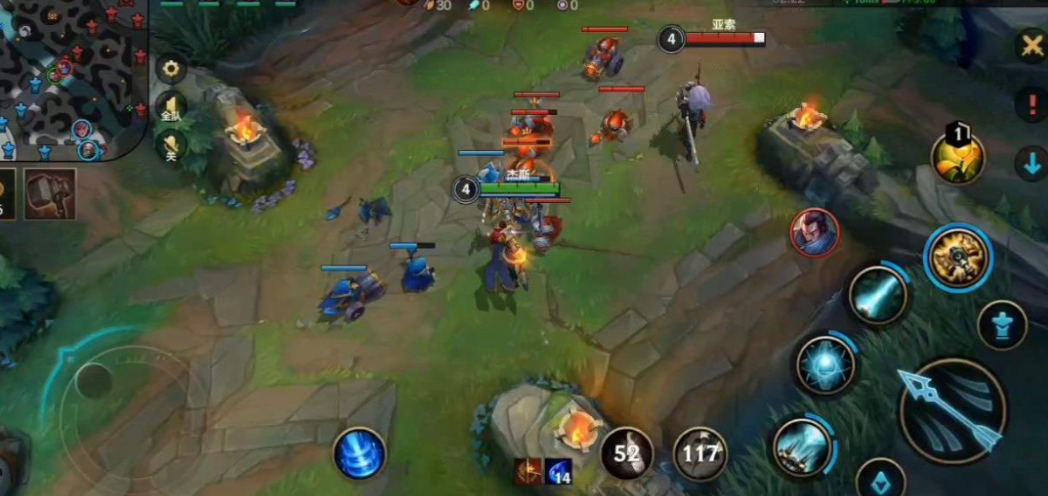 英雄联盟手游杰斯打什么位置